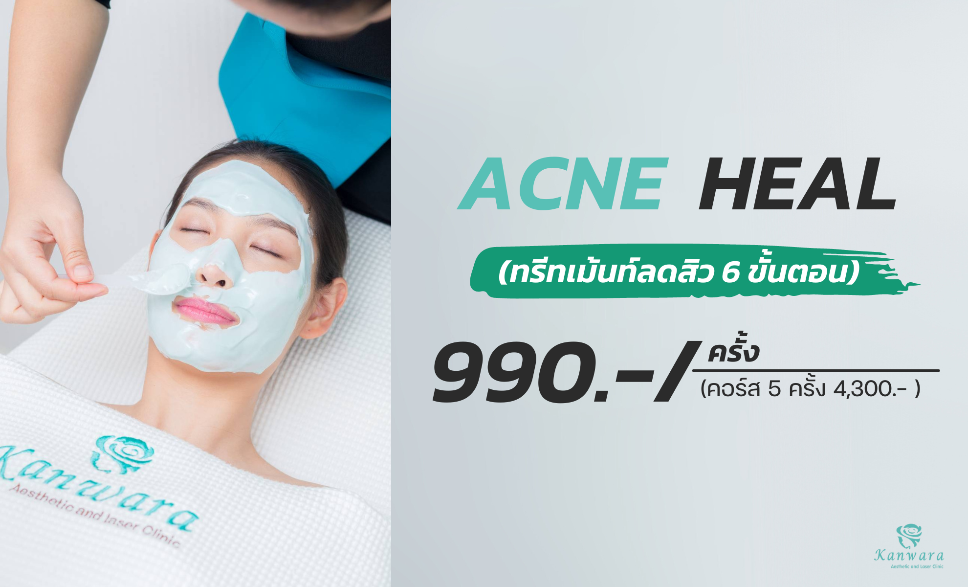 รักษาสิว Acne Heal